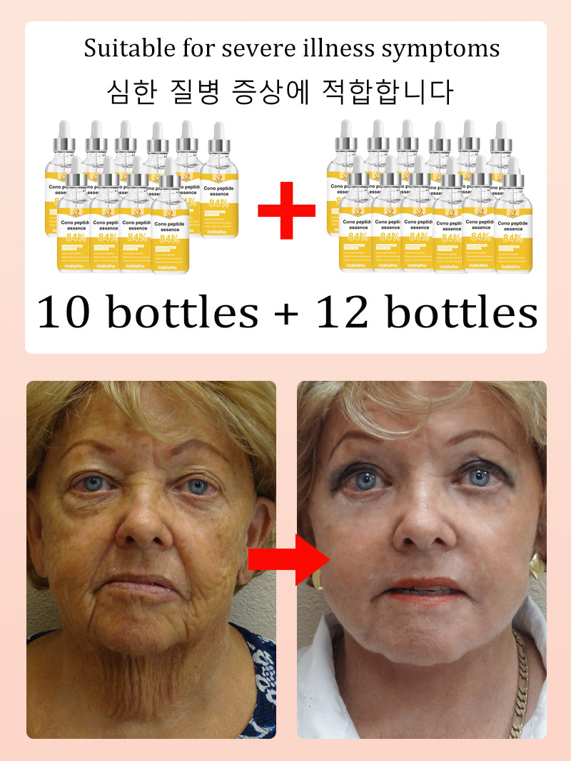 NO Wrinkle 20 Years Younger Facial Cleansing Brush – Ultra-Gentle Silicone Skin Rejuvenation Tool