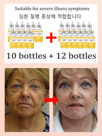 NO Wrinkle 20 Years Younger Facial Cleansing Brush – Ultra-Gentle Silicone Skin Rejuvenation Tool